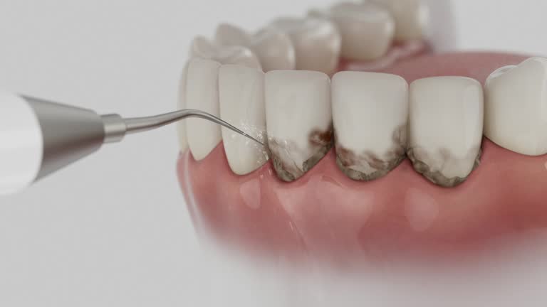 Trusted Root Canal Treatment service in Franklin Furnace, OH - Dentist Open Now